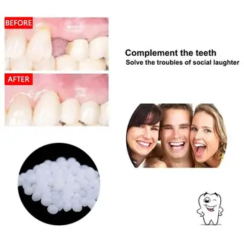 Netikras Dantis Dantų Protezų Klijai Lipnios Dantų Protezų Klijai Dantų Restauracijos Laikinas Dantų Taisymo Rinkinys, Dantų Laminatės Ir Spragas